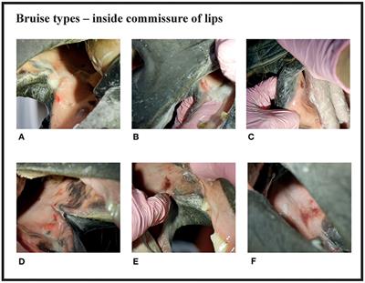 Oral Lesions in the Bit Area in Finnish Trotters After a Race: Lesion Evaluation, Scoring, and Occurrence